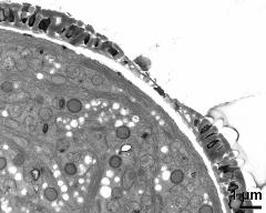 apertural area of pollen wall