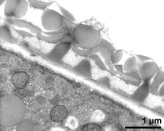 pollen wall, interapertural area