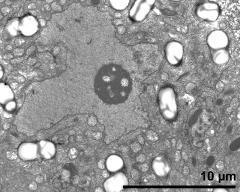 vegetative nucleus and two sperm cells