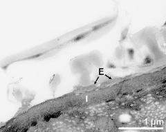 pollen wall at transition of aperture and interapertural area