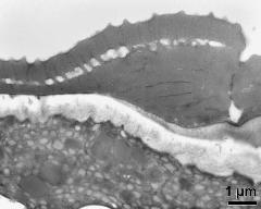 pollen wall at transition of aperture and interapertural area