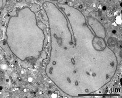 generative cell (left) and vegetative nucleus (right)