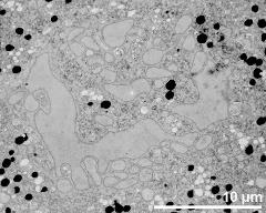 vegetative nucleus