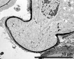 germinating pollen grain