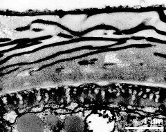 pollen wall (apertural area)