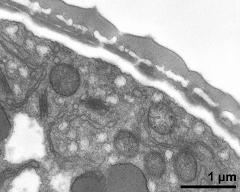 pollen wall, interapertural area