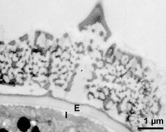 interapertural area of pollen wall, intine (I), endexine (E)