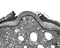 apertural area of pollen wall