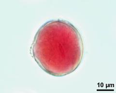 pollen grain with generative cell