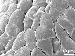 surface of massula,tetrads