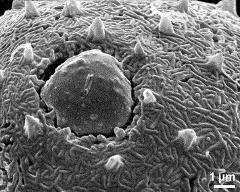 aperture of dry pollen grain