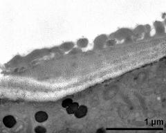 pollen wall at transition of aperture and interapertural area