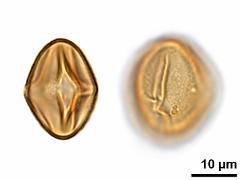 acetolyzed pollen,equatorial view