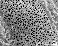 exine surface