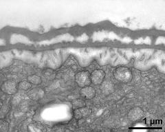 interapertural area of pollen wall