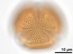 acetolyzed pollen,polar view