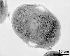 pollen grain in cross section