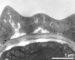 pollen wall, interapertural area