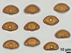 acetolyzed pollen,equatorial view