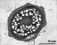 pollen grain in cross section