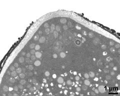 pollen wall, aperture area