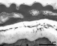 pollen wall at transition of aperture and interapertural area