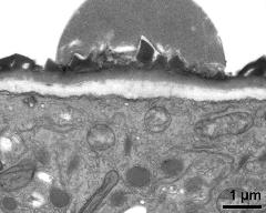 apertural area of pollen wall