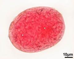 pollen grain with sperm cells (asterisks)