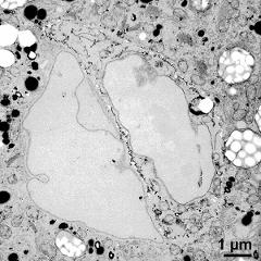 generative cell (right) and vegetative nucleus