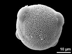 oblique view,tetracolporate (exception)