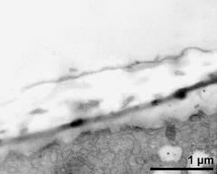 apertural area of pollen wall