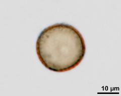 acetolysed pollen, upper focus