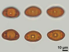 acetolyzed pollen,equatorial view