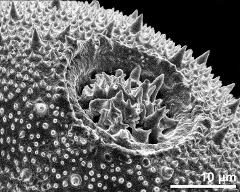 aperture of dry pollen grain