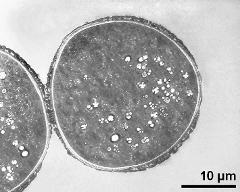 pollen grain in cross section