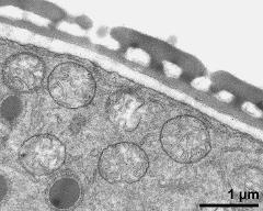 pollen wall, interapertural area