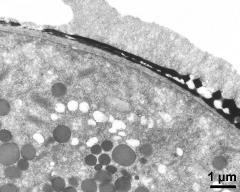 pollen wall at transition of aperture and interapertural area, pollenkitt