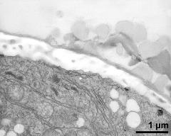 pollen wall at transition of aperture and interapertural area