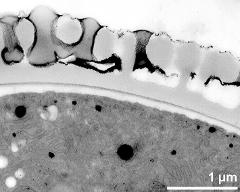 interapertural area of pollen wall