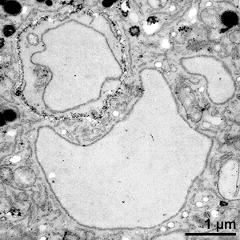 vegetative nucleus and generative cell (top)