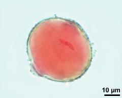 vegetative nucleus and generative cell