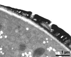 pollen wall at transition of aperture and interapertural area