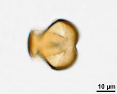 acetolyzed pollen, upper focus