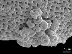 acetolyzed pollen,exine surface,and Ubisch bodies