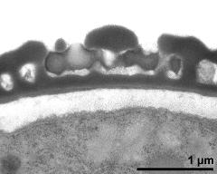 pollen wall, interapertural area