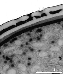 interapertural area of pollen wall