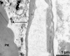 pollen wall (PK) and tapetum cells (TA)