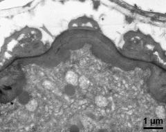 apertural area of pollen wall