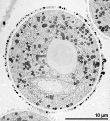 pollen grain in cross section (long-styled morph)