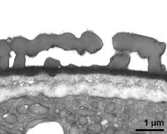 interapertural area of pollen wall